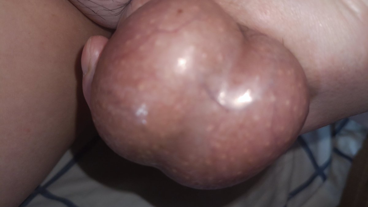 handsherm's tweet photo. #睾丸 #性瘾 #BDSM #CBT #虐蛋 #爆卵 #球 #bigball #SM #balls #重口 #蛋    冒泡，刚洗完澡，放��嘴巴里或者是手里？主页加q，附近可玩😉 https://t.co/cDORk7rwFp