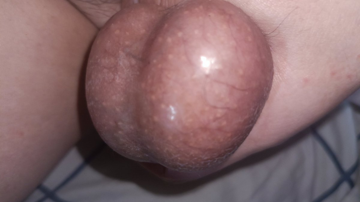 handsherm's tweet photo. #睾丸 #性瘾 #BDSM #CBT #虐蛋 #爆卵 #球 #bigball #SM #balls #重口 #蛋    冒泡，刚洗完澡，放��嘴巴里或者是手里？主页加q，附近可玩😉 https://t.co/cDORk7rwFp