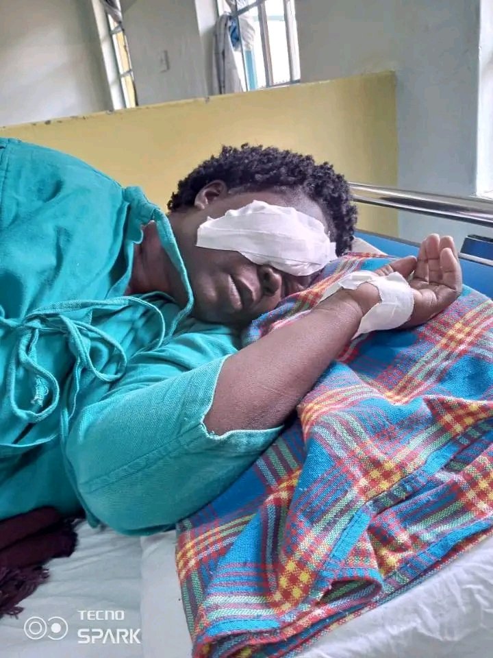 Thriving_luos's tweet image. Can we push for #JusticeForJanet 😭 The widow has lost her sight after her husband&apos;s brother allegedly porched her eye with pliers in Nyaori area, Nyalenda A, Kisumu.

The perpetrator is still walking free and also he is accused of several offences.