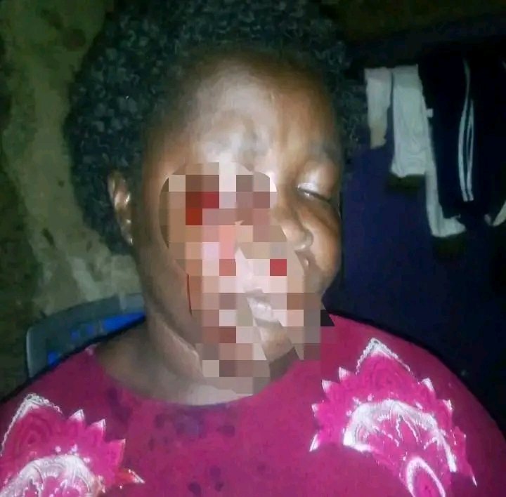 Thriving_luos's tweet image. Can we push for #JusticeForJanet 😭 The widow has lost her sight after her husband&apos;s brother allegedly porched her eye with pliers in Nyaori area, Nyalenda A, Kisumu.

The perpetrator is still walking free and also he is accused of several offences.