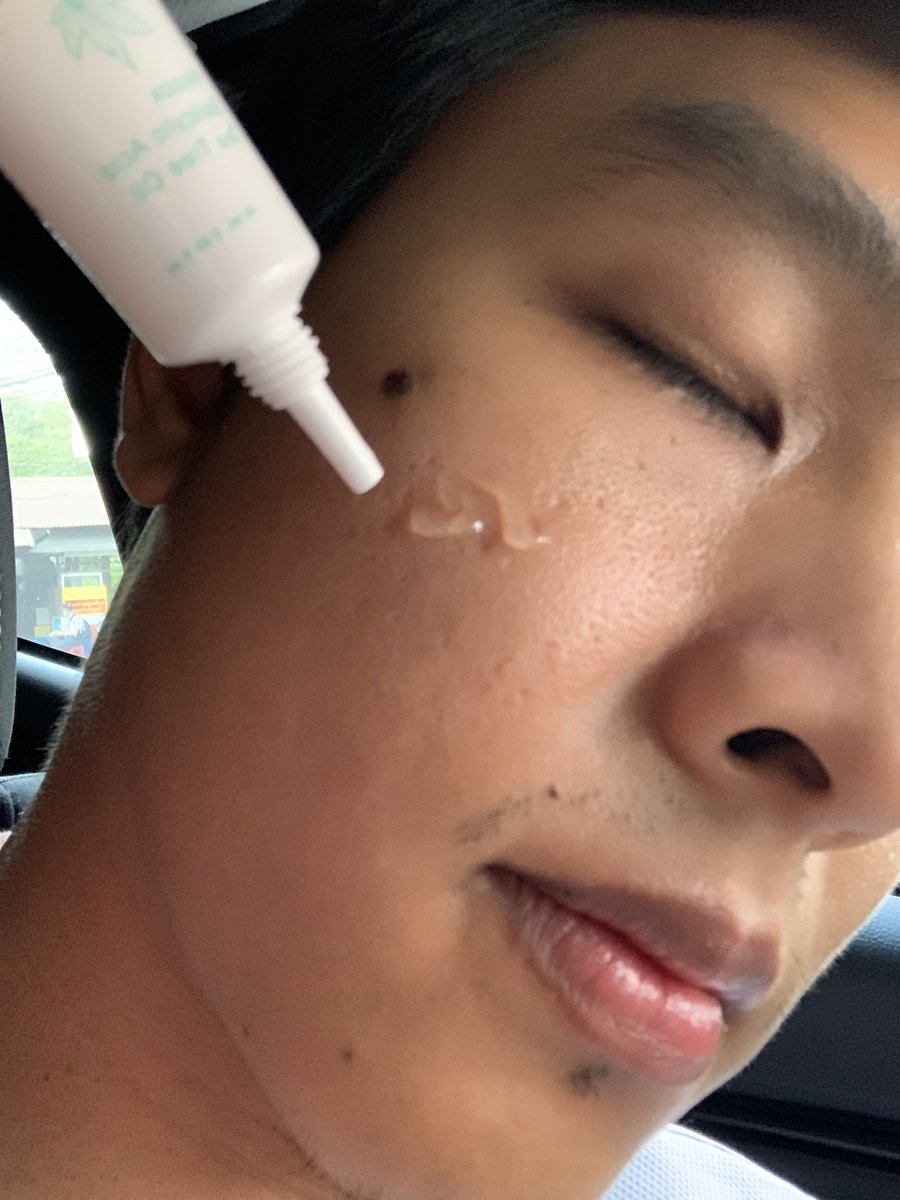 BoVannavat's tweet photo. ปกติเป็นคนหน้ามันผิวแพ้ง่าย ทำให้สิวขึ้นง่ายด้วย แต่หลังจากใช้เจลตัวนี้ทำให้ผิวหน้าดีขึ้น สิวยุบไว และไม่ระคายเคืองต่อผิวเลยใช้ดีมากๆ https://t.co/6Jflvy5Lxe