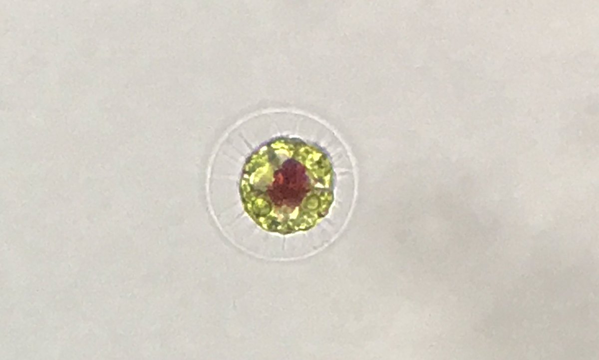Eudorina_ch's tweet photo. この独特な形!
#ヘマトコックス
#haematococcus https://t.co/sPAqylKTKN