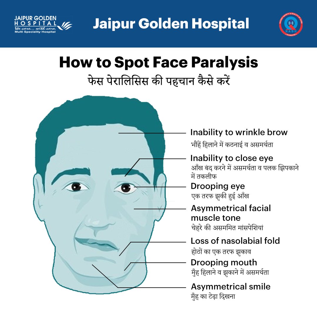 JaipurGolden's tweet photo. For treatment the patient may report to our casualty 24x7 within three hours to get the best cure.
Daily Neurologist | OPD available.
Contact 📞 +91 11 614 06 300
#paralysis #faceparalysis #neurologydepartment #jgh #delhi #hospital https://t.co/1ziWNgDFSh