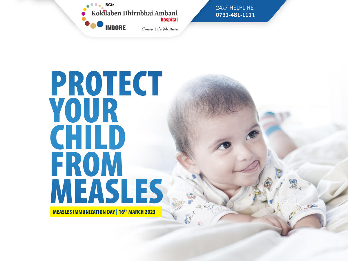 #Measles is a viral infection that spreads easily & can be serious & even fatal for small children. However, it can be prevented with #MMRvaccine. Two doses of MMR vaccine are about 97% effective at preventing measles; one dose is about 93% effective. #MeaslesImmunizationDay