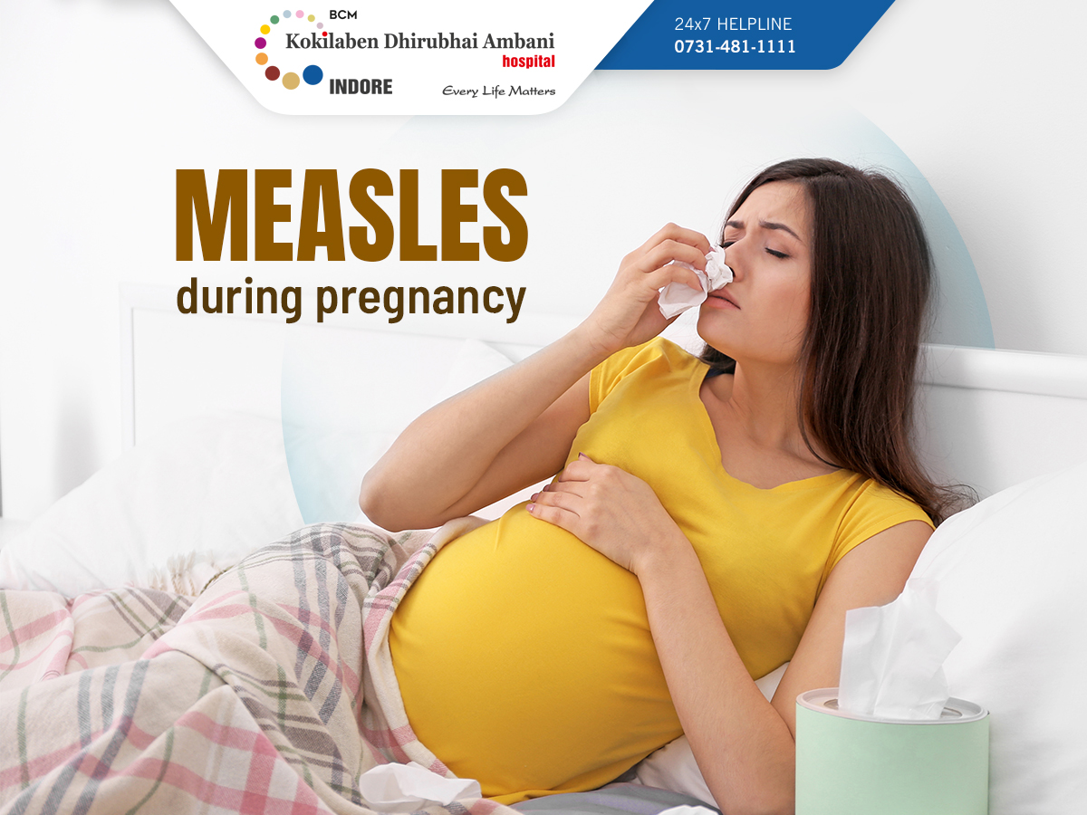 Unvaccinated pregnant women have a high risk of being affected by measles. #Measles during #pregnancy may cause miscarriage, stillbirth, low birth weight & an increased risk of preterm delivery. Consult your #gynaecologist for precautionary measures. #MeaslesImmunizationDay