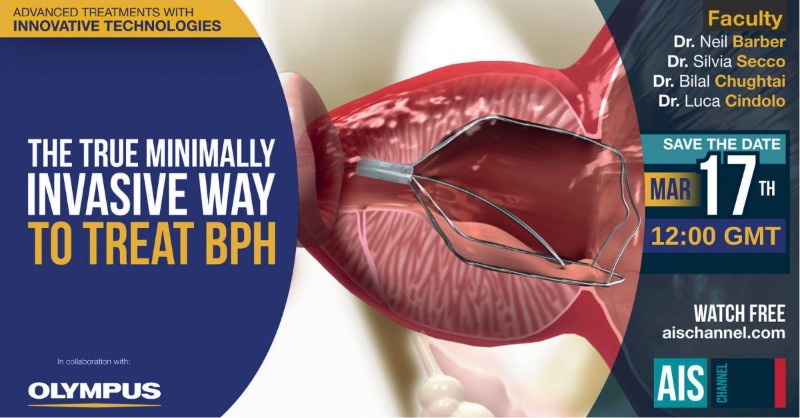 OlympusMedUKIE's tweet photo. ⏰ Don't forget to join us at 12pm today on @AISChannel to hear about #iTind - The True Minimally Invasive Way to Treat #BPH

We'll be covering the iTind procedure, patient selection, clinical evidence, training pathway + Faculty Q&amp;A

FREE to watch online:
https://t.co/i0WDDb58KR