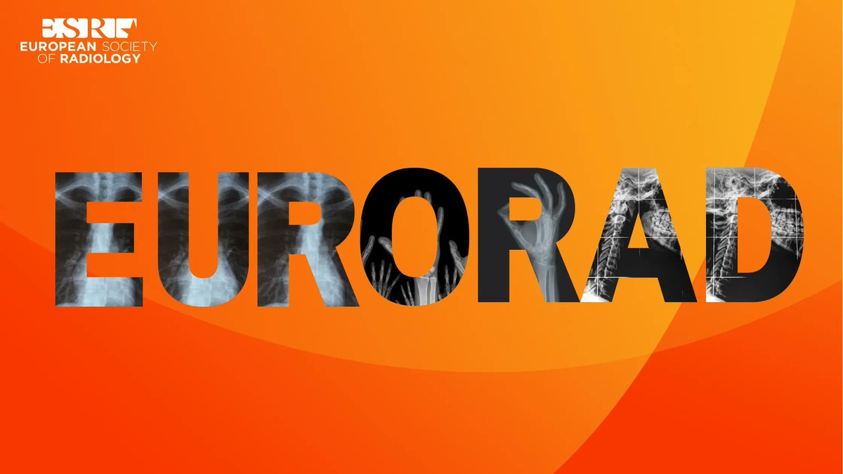 Are you  looking for a valuable resource to enhance your knowledge? Look no further than Eurorad! 

Discover Eurorad today and take your expertise to the next level! 

Visit ▶️  buff.ly/3ZLa4zH to learn more!
#Eurorad #radiology #radiography #medicalimaging