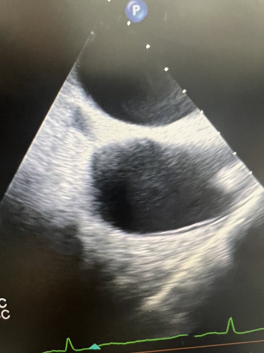 Amir Kaki, MD tweet media