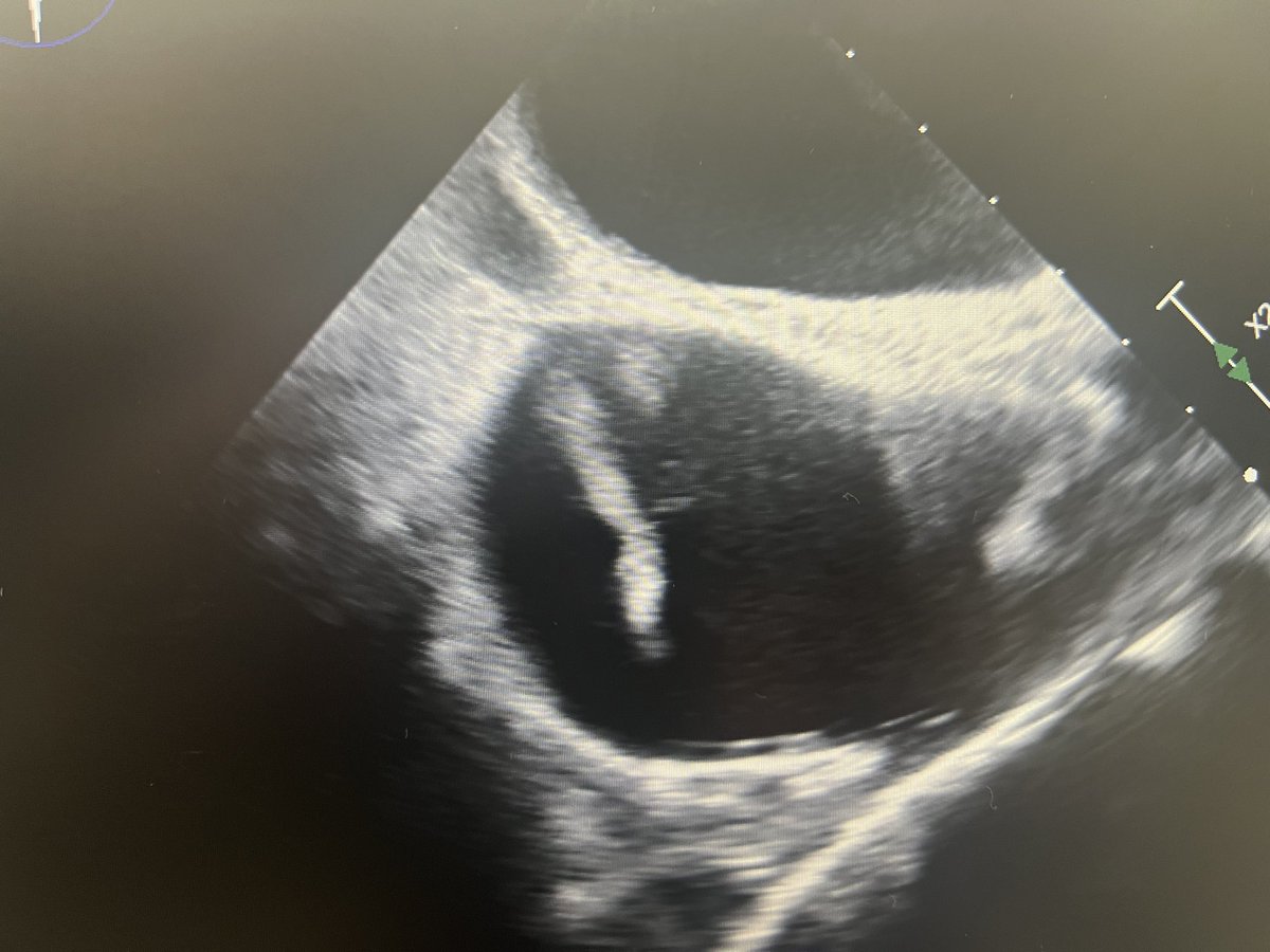 Amir Kaki, MD tweet media