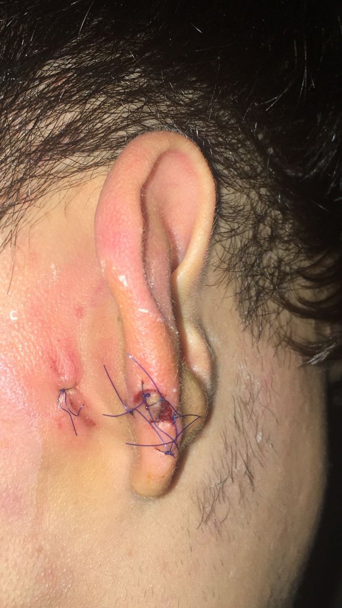 andyferreyra's tweet photo. 🔴Córdoba: trascienden más ataques en la zona de la Terminal de Ómnibus, a metros de una Comisaría

Un chico de 17 años fue atacado por 3 hombres en la Plaza de los Niños: sufrió 2 puntazos y un fuerte golpe antes de que le robaran.

Hay decenas de denuncias por hechos similares. https://t.co/avriZUZ6UY