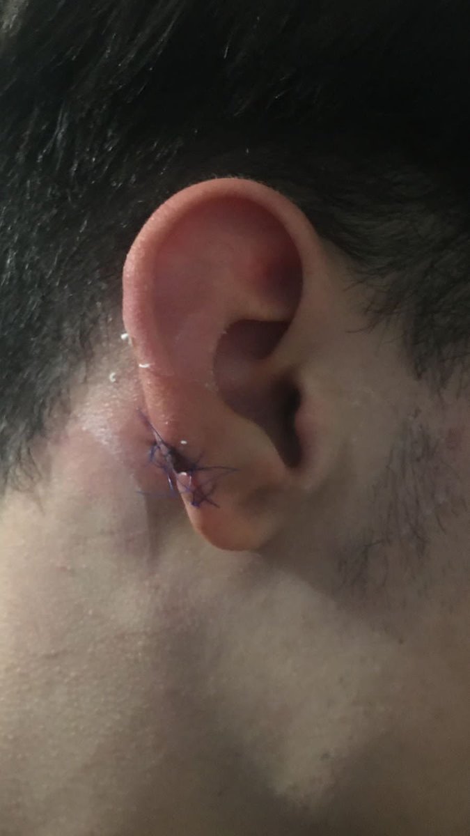 🔴Córdoba: trascienden más ataques en la zona de la Terminal de Ómnibus, a metros de una Comisaría

Un chico de 17 años fue atacado por 3 hombres en la Plaza de los Niños: sufrió 2 puntazos y un fuerte golpe antes de que le robaran.

Hay decenas de denuncias por hechos similares.