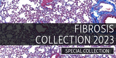 JExpMed's tweet photo. We are pleased to present a special collection of articles on lung, liver &amp; cardiac #fibrosis, fibroblast-immune cell interactions, &amp; the genetic basis of nonalcoholic fatty liver disease (#NASH) to accompany @KeystoneSymp #KSFibrosis23 &amp; #KSNASH23 https://t.co/aGNLn2pYPj https://t.co/VfsCZY4v46