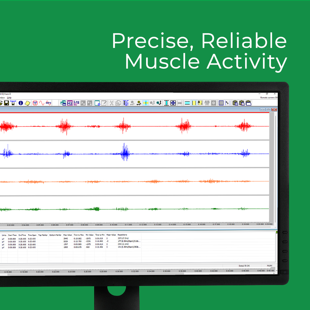 BiometricsLtd's tweet image. Check out the wireless DataLITE EMG systems from Biometrics Ltd! This innovative device is perfect for recording muscle activity and providing valuable insights into athletic performance. 
More info: biometricsltd.com/emg 
#emgsensor #electromyography #muscleemg #sportsescience