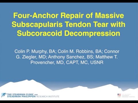 drprovencher's tweet photo. In this video, Dr. Provencher describes a four-anchor repair of a massive #subscapularis tear with subcoracoid decompression. https://t.co/0nEQNUSu1E #orthotwitter #medtwitter https://t.co/TnAsTFKk6S
