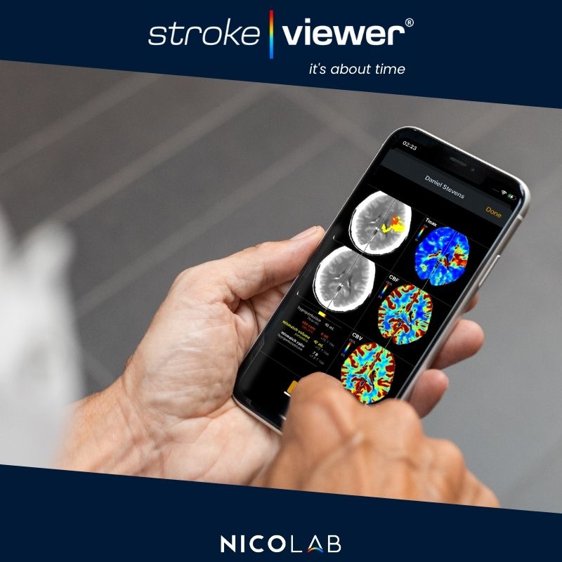 Nicolab_AI's tweet photo. With #StrokeViewer's mobile DICOM viewer certified for diagnostic use: physicians can diagnose #stroke patients from home (or on the go) via their devices, saving critical Time-To-Treatment.🧠

StrokeViewer: a solution for #physicians by physicians!🏥

👇
https://t.co/dKWr5U9xmG https://t.co/odfG9J0PAa