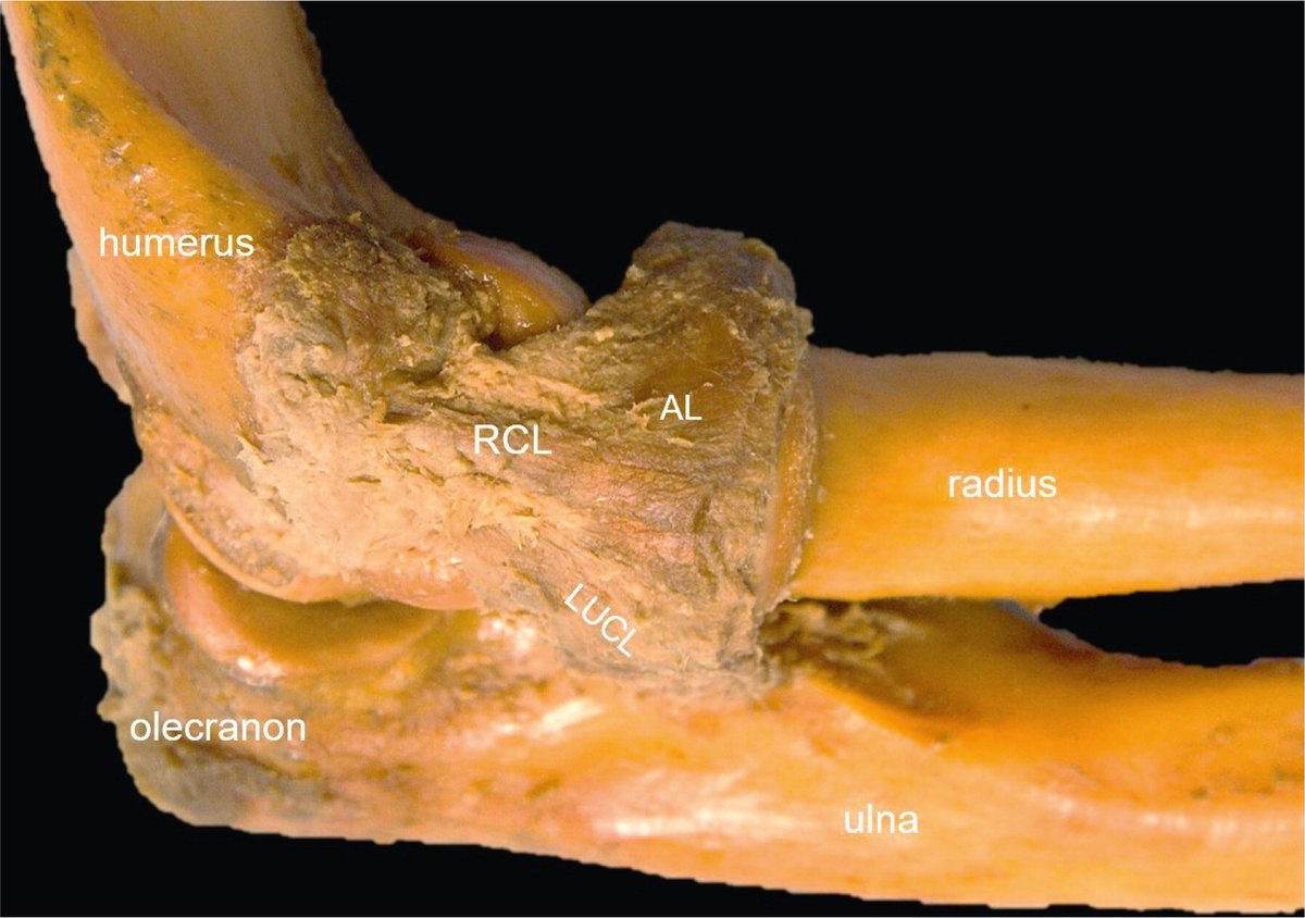 Rheumatology's tweet photo. In this article, we discuss exemplary sonographic pathologies of the elbow, highlighting important structures that should be systematically examined in the corresponding elbow region. Thank you @riccivincenzo17 for the great support
https://t.co/H9pta71vgW https://t.co/3yKbkljQ4Y