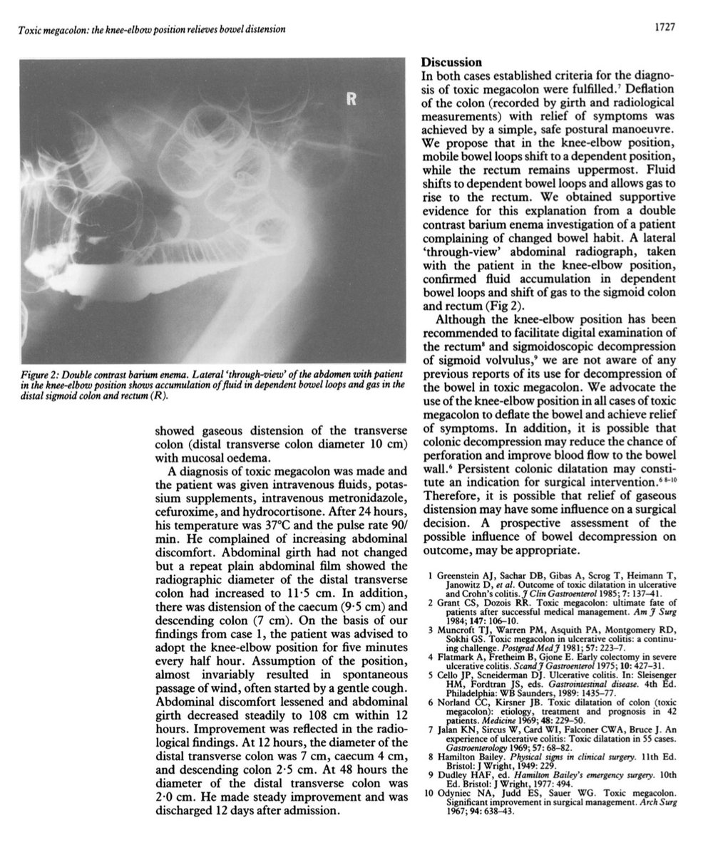 Keith Siau On Twitter Here Is A Trip Down Memory Lane From Gut BMJ keith-siau-on-twitter-here-is-a-trip-down-memory-lane-from-gut-bmj