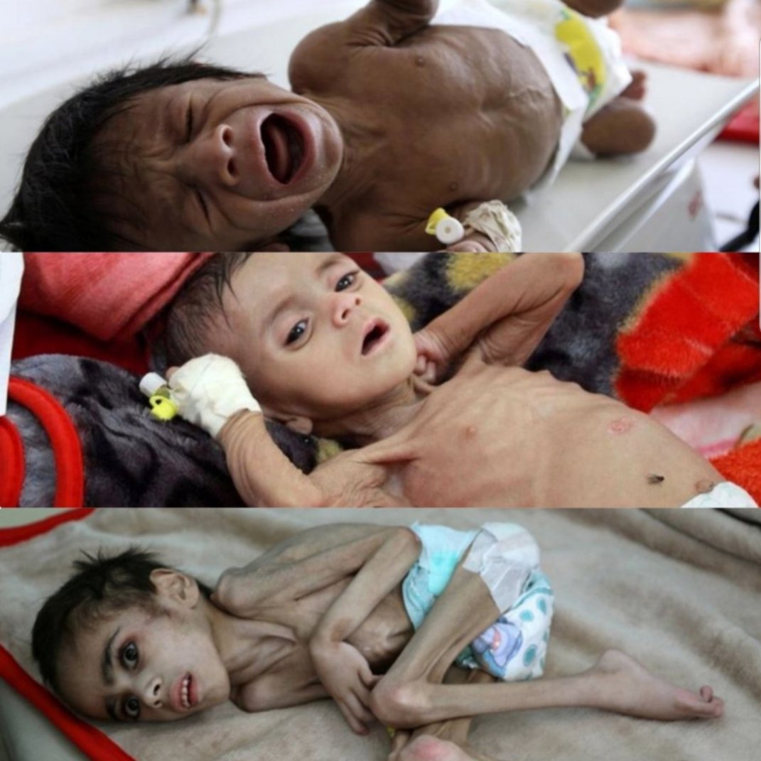 NofalGgmailcom1's tweet photo. @antonioguterres We will not despair of appealing to the Secretary-General of the United Nations.  Mr. Anthony Guterres.  Although ignore it.  We have no other choice, as we are suffering under the weight of war, aggression, unjust blockade, and the violations of the French Total Yemen Company. https://t.co/3I6erA5Vdn