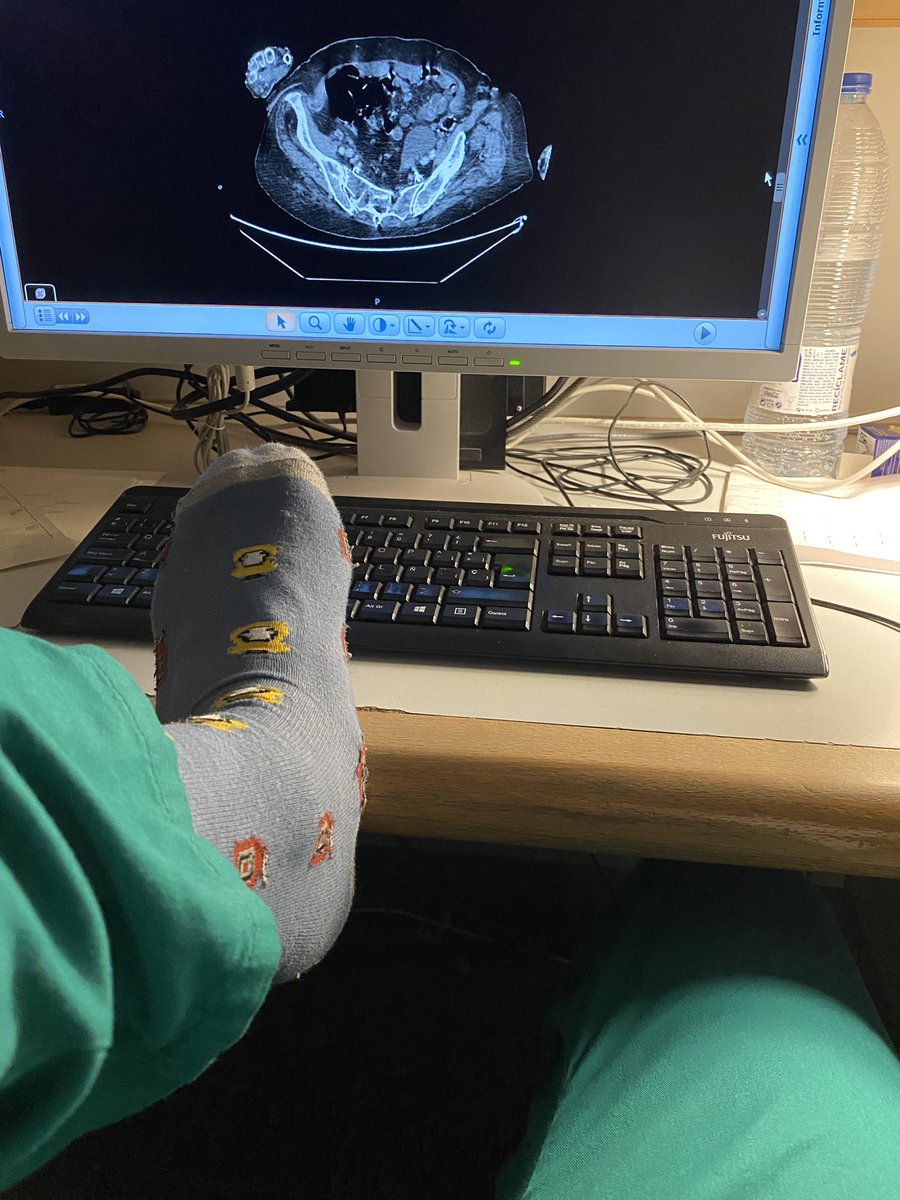 DavidRR_MD's tweet photo. El otro día subí esta foto sin más, pero he pensado contaros el por qué de esta foto. A las 5 y algo de la mañana, después de unas 20h trabajando y sin haber podido dormir nada, me pasaron a observación a una abuelita muy mayor por una insuficiencia cardíaca descompensada. https://t.co/B00TtPnemW