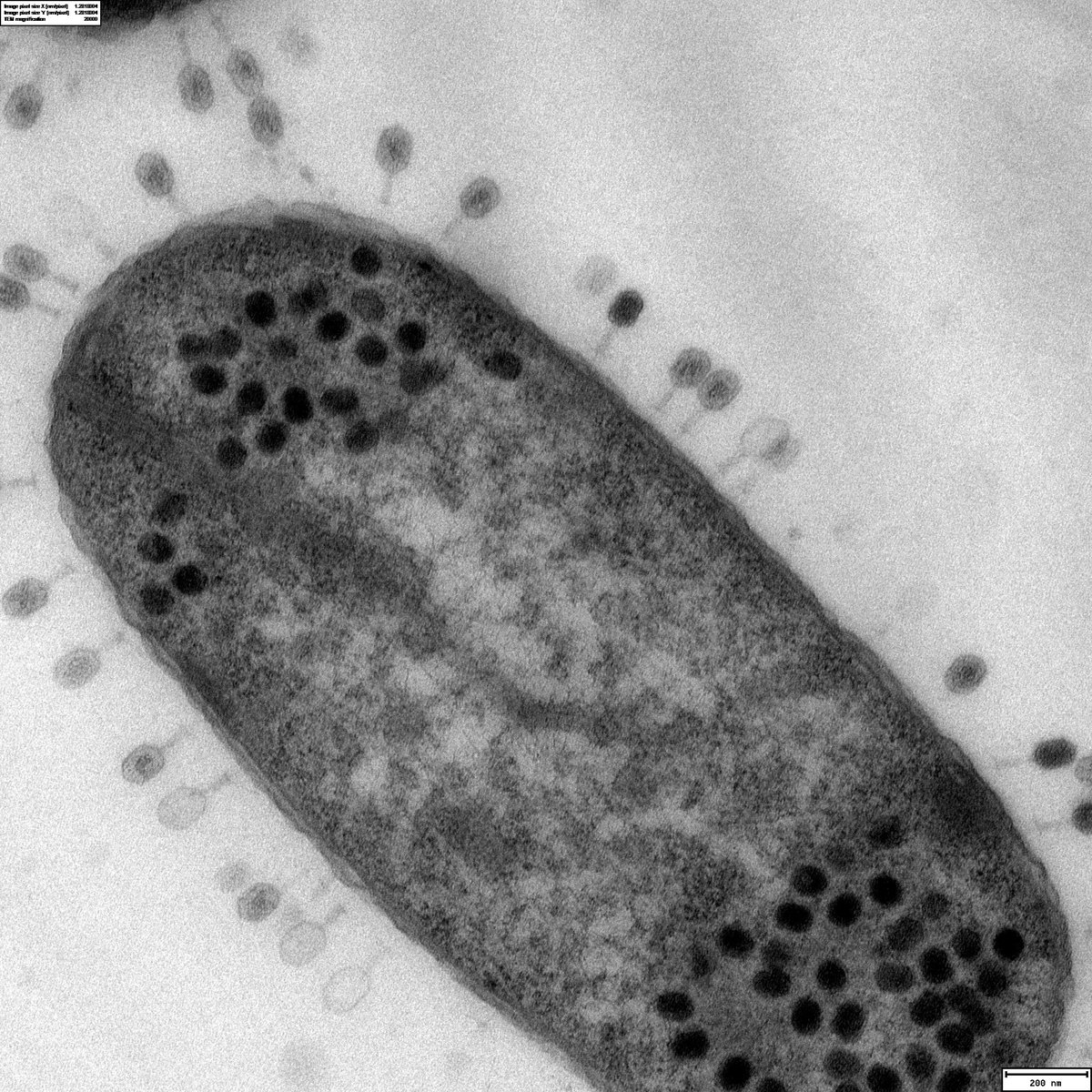 That's the reason I love #electronmicroscopy You can see cool stuff like this :D Any ideas what's going on here?