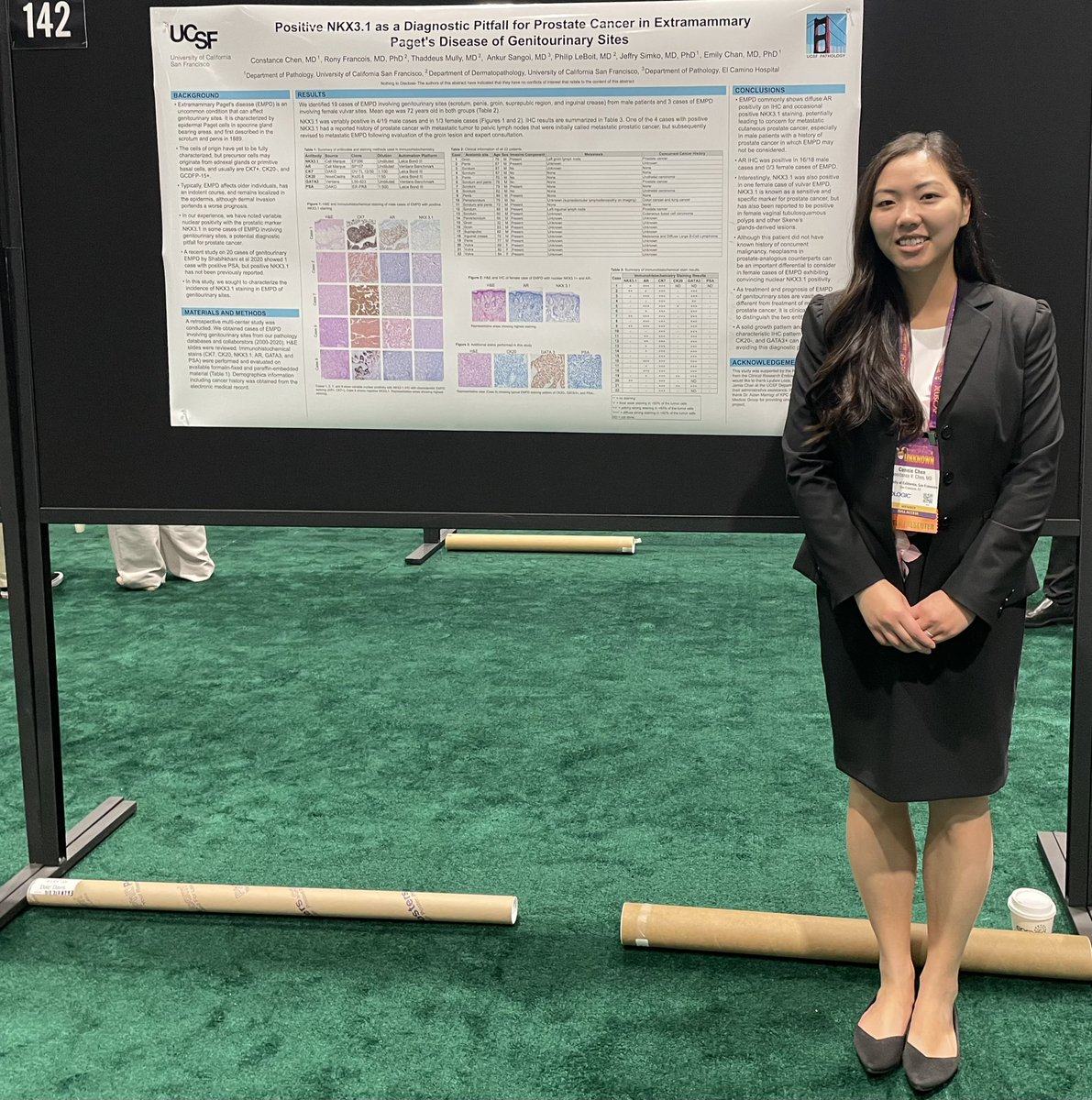 I’m back in SF and already having #USCAP2023 withdrawals! Had so much fun in New Orleans and learned a lot. Thankful for the opportunity to present our poster on NKX3.1 staining in EMPD of GU sites! #UCSFpathology @UCSFPath @slusagar @chemily7