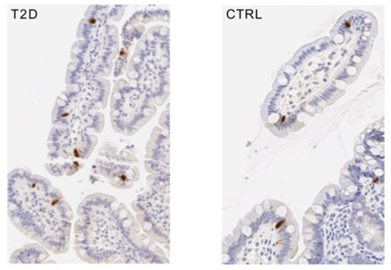 Filip_Knop's tweet photo. Happy to serve you the next chapter of our human enteroendocrine cell atlas🤓 @HannahVigh counted thousands of neurotensin-secreting N cells... 
https://t.co/dHBOW561Ao https://t.co/xiTaHWrERo