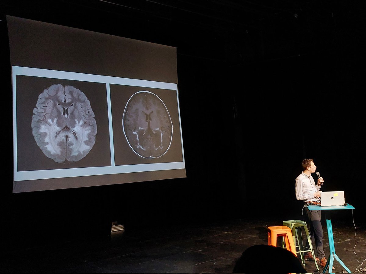 Semaine du Cerveau Dijon tweet media