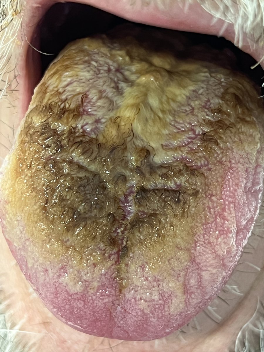 Incidental finding prior to endoscopy. What’s the diagnosis? #WithConsent