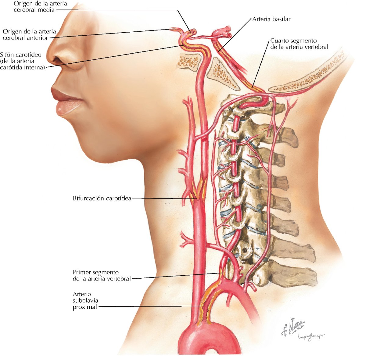 Localizaciones más frecuentes de la #aterosclerosis en la circulación  cerebral: 📌Bifurcación de la arteria #CarótidaComún 📌#SifónCarotídeo  📌Ramas principales de las arterias cerebrales media (ACM) y anterior (ACA)  📌Arteria subclavia proximal, image size:1200x1169