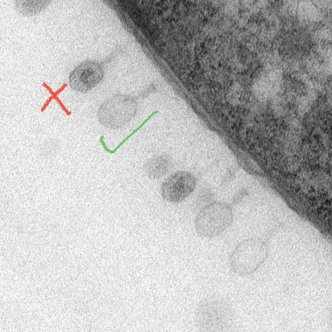 I love that you can see which phages have injected their DNA and which have yet to