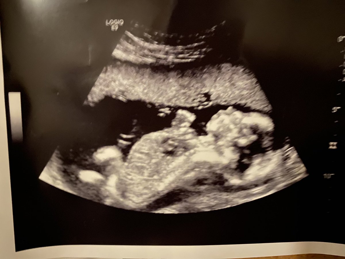 iRebuke_T's tweet photo. This little boy is the 2nd coming of my happiness💙🥺 https://t.co/IpTEWQ1Bh2