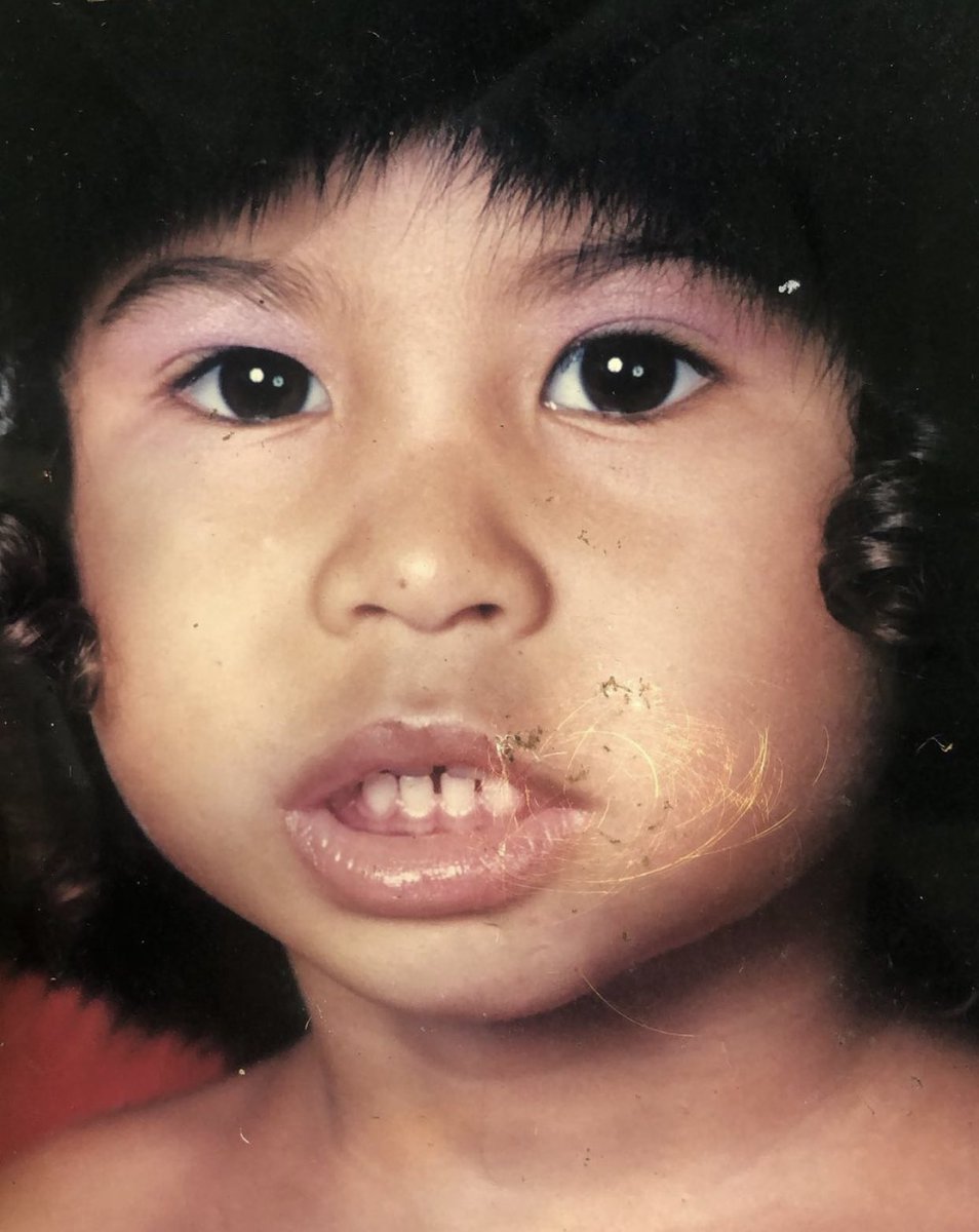eicheela's tweet photo. Baby/ now https://t.co/3mHmCaMTyN