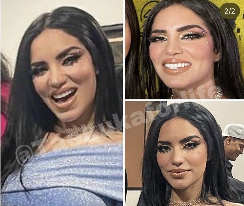 AICONICK_'s tweet photo. Como es posible que esta mujer halla arruinado su cara de esa forma, que le paso? https://t.co/XiWQ27WMXD