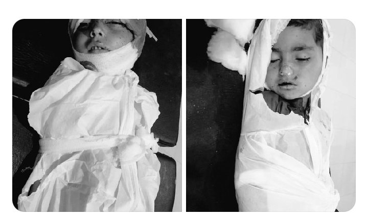 MehtabWaxir's tweet photo. ہاں یہ ہونا باقی تھا ہمیشہ پشتونوں کو میدان دھکیل دیے جاتے ہیں۔ اور یہاں دور دراز پہاڑی علاقوں میں رہنے والے ہر دن موت اور زندگی کی جنگ لڑ رہے ہیں اور وہ بھی اپنے محافظوں اور چوکیداروں سے ۔

#DroneAttack #Pathans #زمان_پارک_پہنچو https://t.co/zyHIcb0DgO