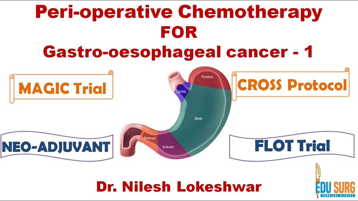 edusurg_clinics's tweet photo. #Chemotherapy In #GastricCancer &amp; #Esophageal #Cancer - Basis, MAGIC Trial, FLOT Trial, CROSS Protocol - This is the first part of the video on the role of chemotherapy ... Watch full video: https://t.co/nxDDBT7hN8 | https://t.co/U3nhLLCzbk 

 #EDUSurgClinics #Mumbai #India https://t.co/X1xw8Vr0Z2