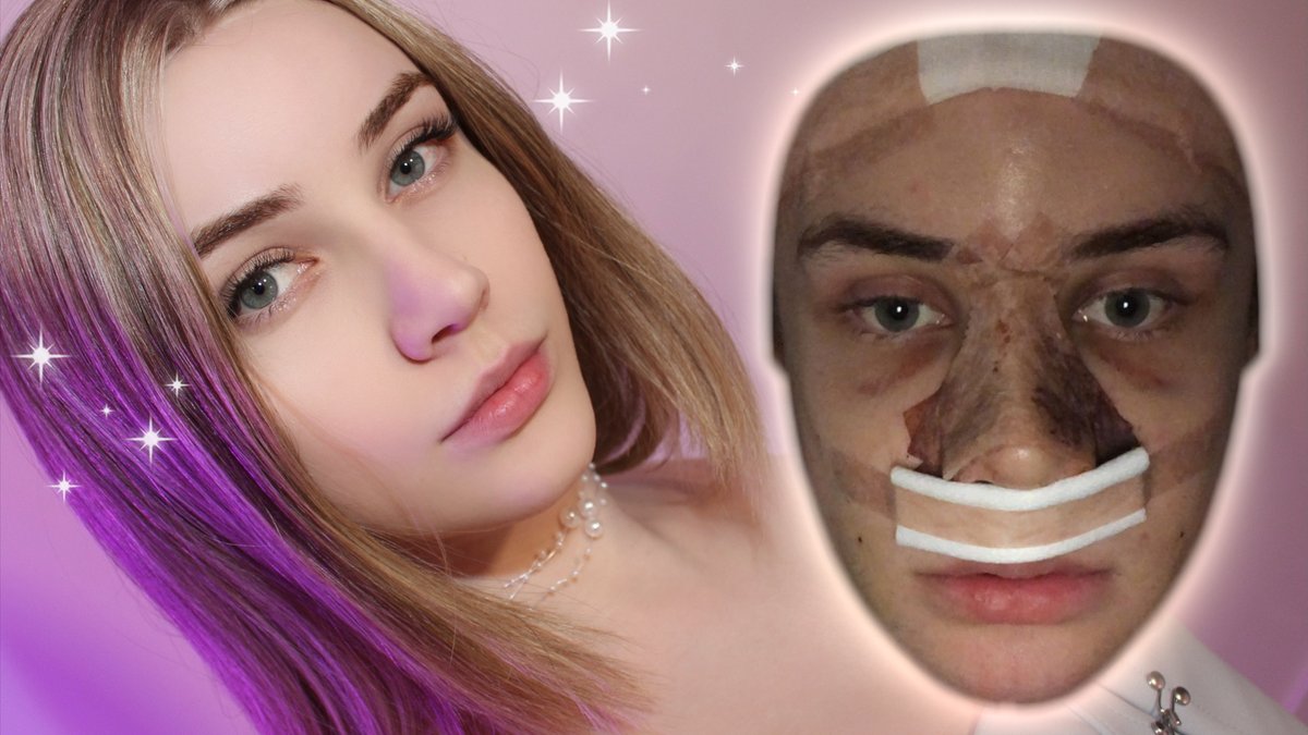 cluamsutherland's tweet photo. plastic surgery update and *face reveal* after 3.5 years!

🔗https://t.co/CAfrXgCijB https://t.co/nvVr79Kckl