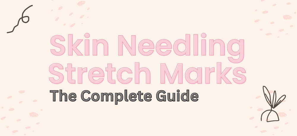 essentialderma's tweet photo. Skin Needling For Stretch Marks: The Full Microneedling Guide.
https://t.co/kxJ4azSRFo
#stretchmarks #stretch #marks #skincare #skinneedling #microneedling #dermaroller #skin #essentialderma https://t.co/7VxxIvBPqi