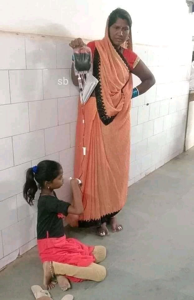 VenkatTrs3's tweet image. దేశ ప్రధానమంత్రి మోతీజీ సొంత రాష్ట్రం గుజరాత్ ప్రభుత్వ ఆసుపత్రిలో 
ఇదే గుజరాత్ మోడల్😥

డబుల్ ఇంజన్ సర్కార్ పాలన ఇది 👇.

#DoubleEngineTroubleEngine
#GujaratModel.