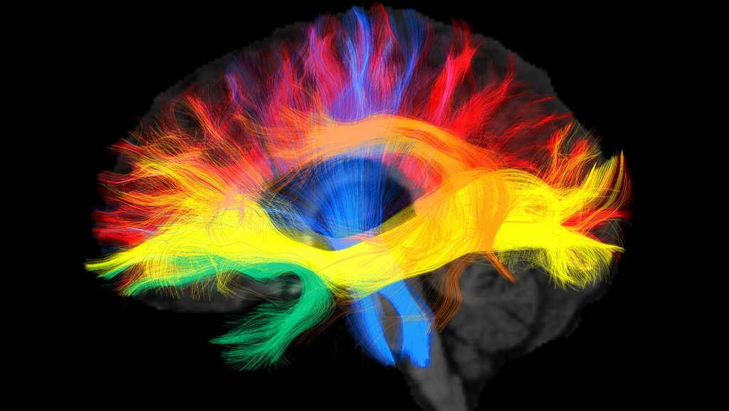 MPI_CBS's tweet photo. Die #Muttersprache, die wir sprechen, prägt die Verschaltung in unserem #Gehirn und kann unser Denken beeinflussen. Das zeigen SprachforscherInnen des @FriedericiLab in ihrer Studie @NeuroImage_EiC 📃 🧠 https://t.co/Pxsys0u0C2
Team um @AlfredAnwander macht Verbindungen sichtbar: https://t.co/v1LLi0VMtR