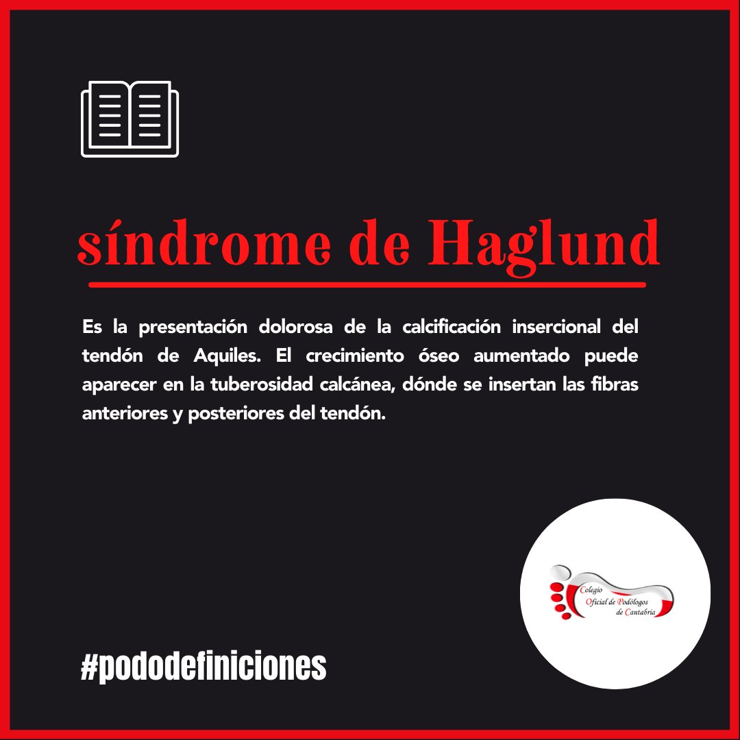 podologoscanta1's tweet photo. 🔴⚫️ Acudimos a una nueva cita en nuestra sección semanal con el diccionario ▶️ 𝒔í𝒏𝒅𝒓𝒐𝒎𝒆 𝒅𝒆 𝑯𝒂𝒈𝒍𝒖𝒏𝒅

¿Se te ocurren otras palabras relacionadas con la podología que sean de interés o curiosas? Cuéntanos!

#pododefiniciones https://t.co/lP6tQ7kkSM