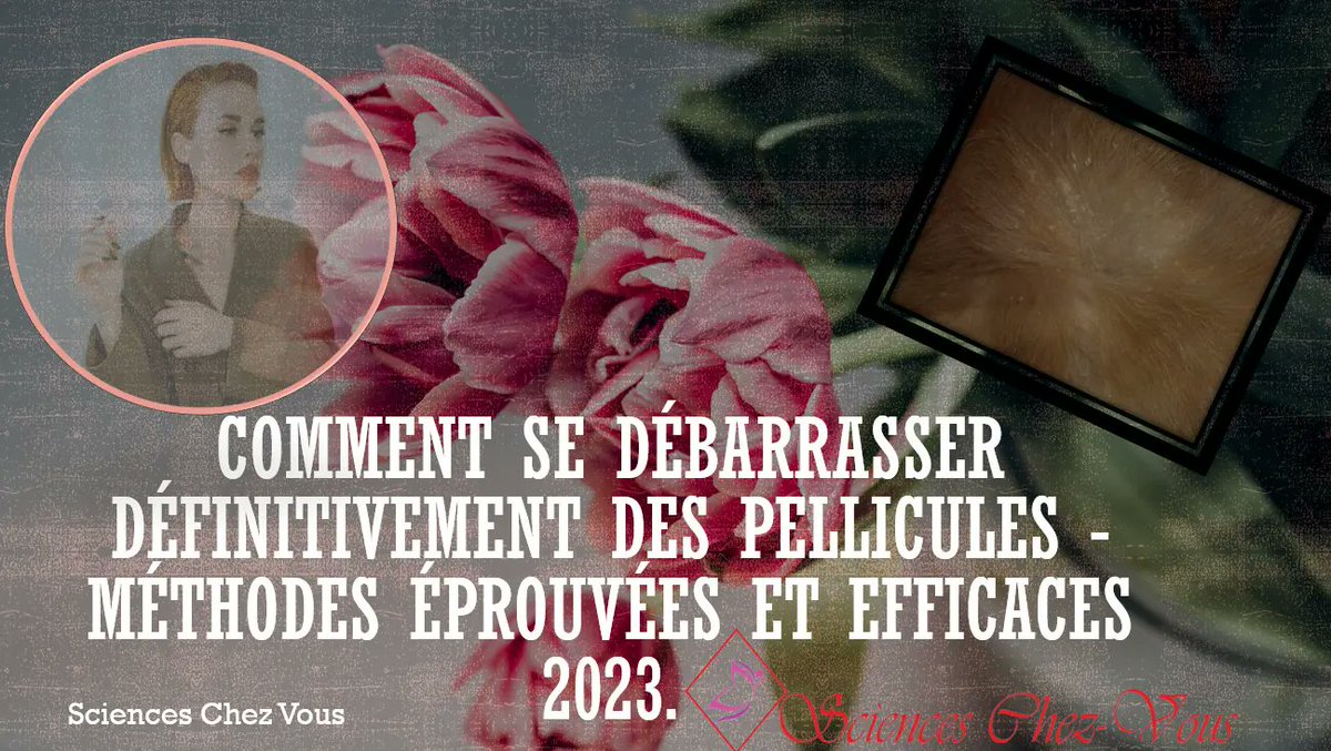 ChezScience's tweet image. Sciences Chez Vous: Comment se débarrasser définitivement des pellicules scienceschezvous.com/2023/03/se-deb…