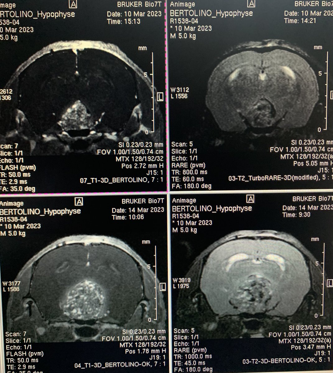 Philippe Bertolino (@bertolino_lab) on Twitter photo Building preclinical models at <a href="/cermep/">BRUNO DISCH</a> and <a href="/crcl/">Cancer Research Center of Lyon</a>…. Super excited to image the longitudinal progression of tumour cells we grafted in mouse pituitaries
<a href="/GeraldRaverot/">Gerald Raverot</a> et <a href="/Bertolino_Lab/">Philippe Bertolino</a> , #pituitary, #MRI Building preclinical models at <a href="/cermep/">BRUNO DISCH</a> and <a href="/crcl/">Cancer Research Center of Lyon</a>…. Super excited to image the longitudinal progression of tumour cells we grafted in mouse pituitaries
<a href="/GeraldRaverot/">Gerald Raverot</a> et <a href="/Bertolino_Lab/">Philippe Bertolino</a> , #pituitary, #MRI