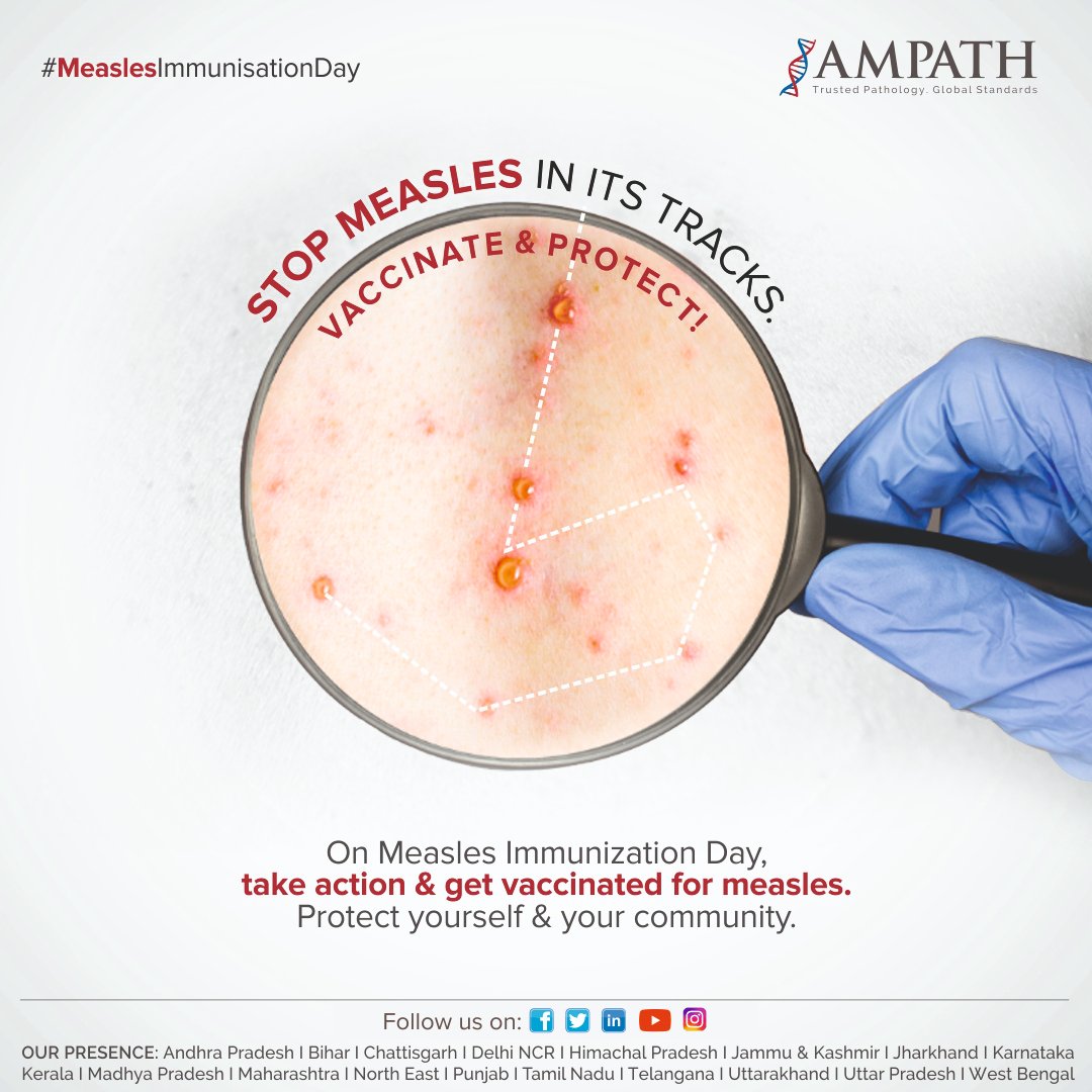 #Measles is a contagious viral infection that affects children under the age of 5. #Measlesvaccination is the best way to prevent this disease. On this #MeaslesImmunizationDay let’s promote the importance of getting vaccinated against measles #AmpathLabs #MeaslesVirus