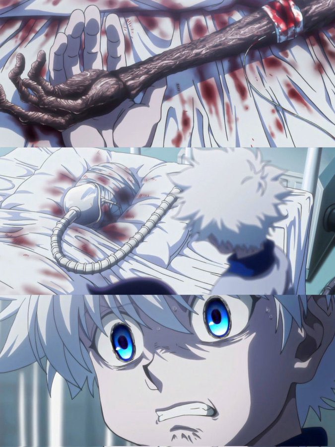 MoltresFf's tweet photo. #hunterxhunter #kurapika #anime #ineed #hunterxhunteredit #killua https://t.co/kfxAZR209H