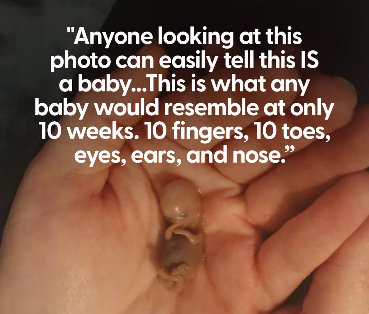 Kyle (@kylebra78) on Twitter photo 