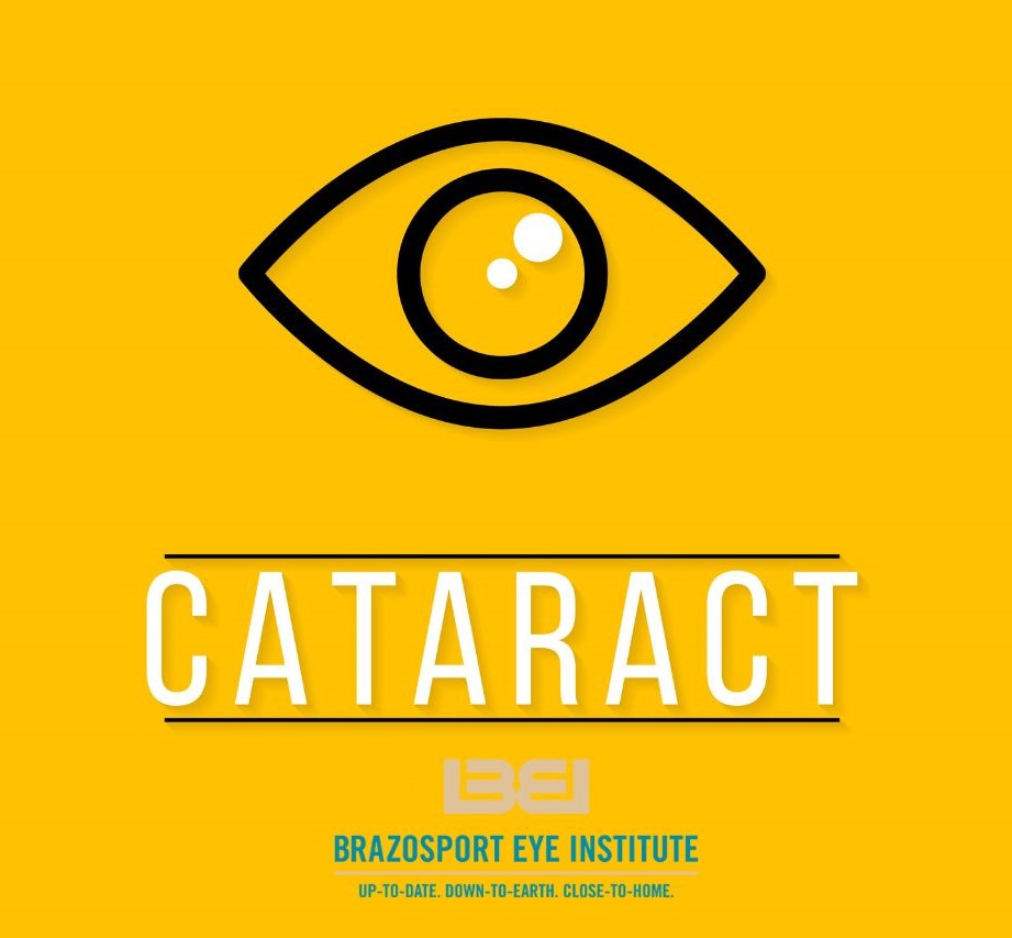 BrazosportEye's tweet image. #Cataracts are age-related #eyeproblem. Our well-trained staff and surgical coordinators work closely with patients and walk them step-by-step through the eye #cataractsurgery process. brazosporteye.com/our-vision-ser…