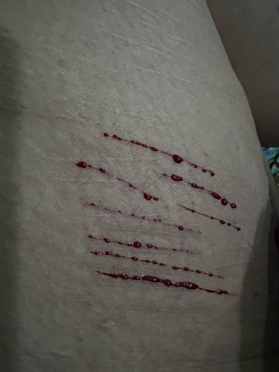 Faris_first_st's tweet photo. สุดท้ายมันก็วนมาที่เดิม #BPD #โรคซึมเศร้า https://t.co/IGHowcu0BL