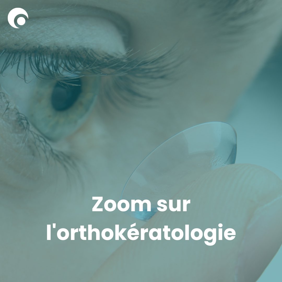EnsembleMyopie's tweet photo. 🔎Zoom sur l'orthokératologie

De quoi s'agit-il ?
👉 Cette technique consiste à porter des lentilles rigides la nuit qui ont pour effet de remodeler uniquement la couche superficielle de la cornée (épithélium). 

Plus d'informations sur ce lien : https://t.co/18GahxsPHJ

#myopie https://t.co/sv7lP83GNN