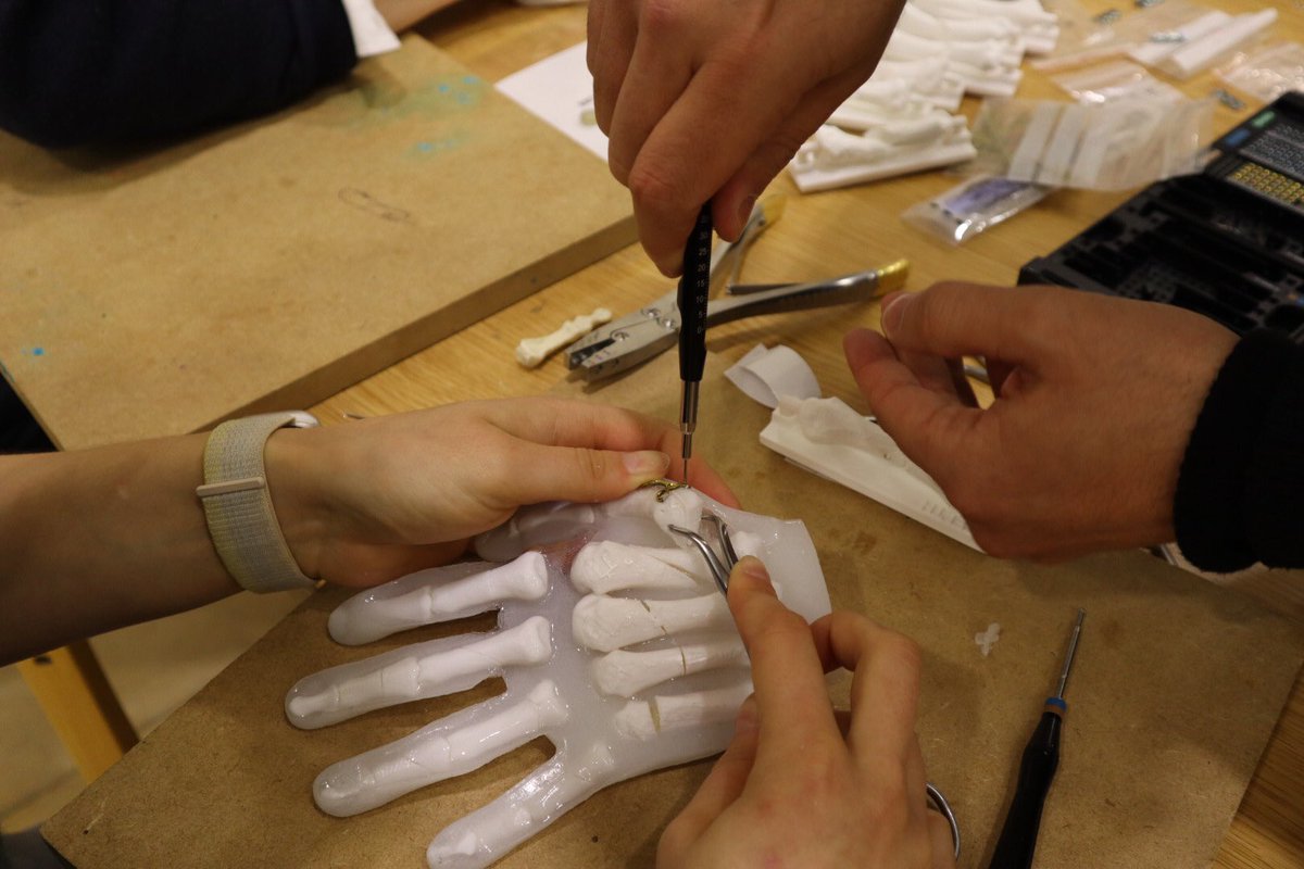Great Hand Fracture Fixation Teaching Session in John Radcliffe Hospital, Oxford University NHS Trust <a href="/OUHospitals/">OUH</a> using 3D printed <a href="/Stelth_Tech/">Stelth</a> models and <a href="/Medartis_UK/">Medartis UK</a> Hand Sets!
