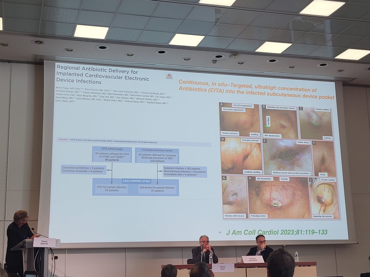 Rythmo_SFC (@rythmo_sfc) on Twitter photo Exctraction de sondes: développement et avenir de la technique présentée par <a href="/PascalDefaye/">Defaye Pascal</a>
L'expérience grenobloise et de nouvelles data récentes également sur la perfusion locale d'antibiotiques⤵️
#JourneesStimDef2023 Exctraction de sondes: développement et avenir de la technique présentée par <a href="/PascalDefaye/">Defaye Pascal</a>
L'expérience grenobloise et de nouvelles data récentes également sur la perfusion locale d'antibiotiques⤵️
#JourneesStimDef2023